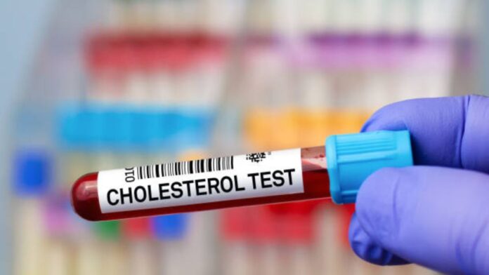 Cholesterol test price in Mumbai