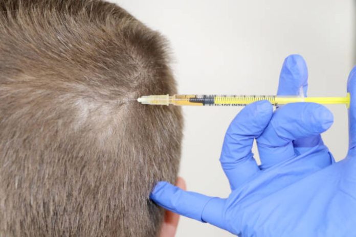 Why Turkey is the Worldwide Hub for Hair Transplants